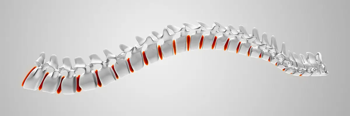 chiropractic-biophysics-img